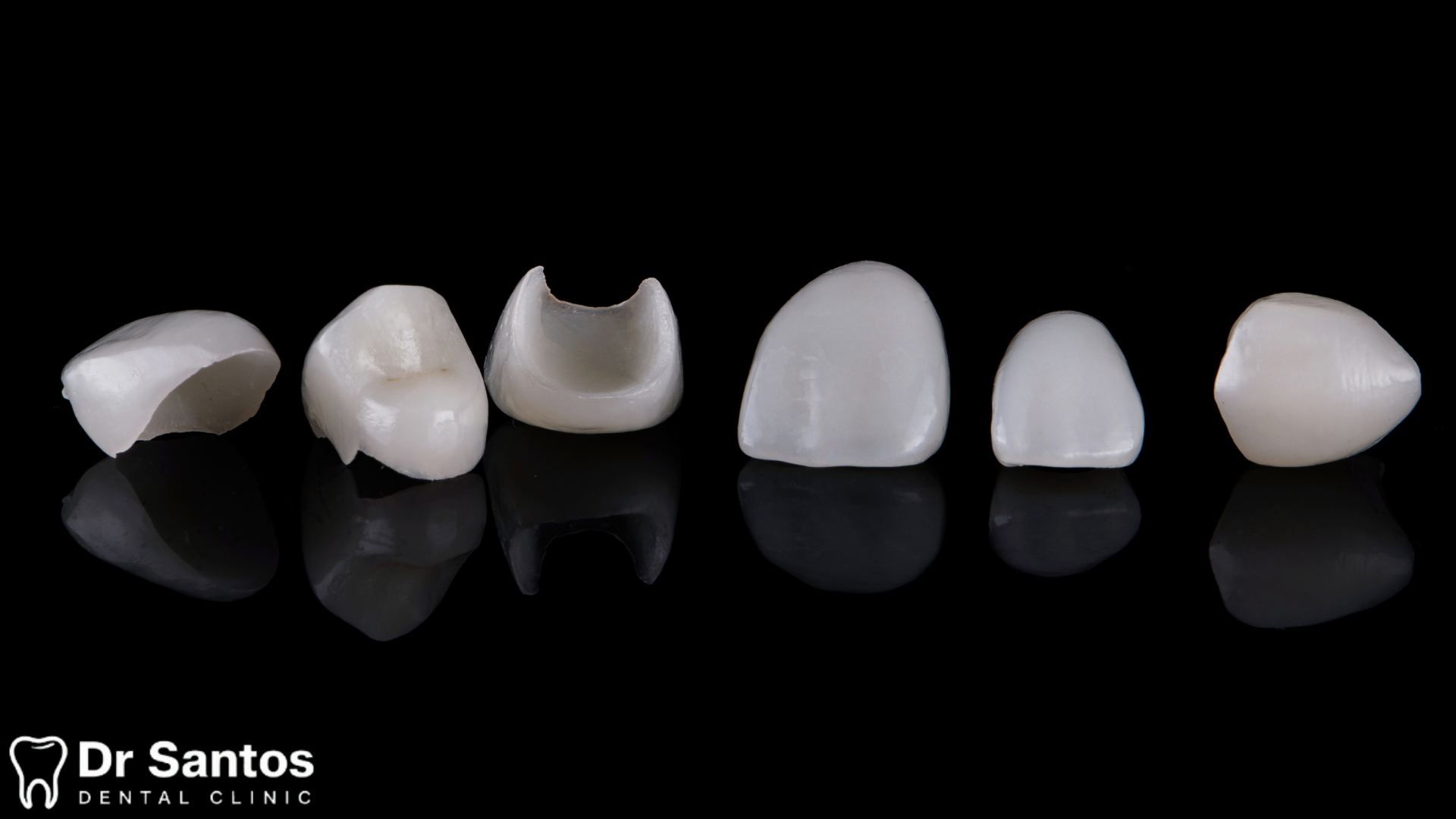 Diagrama mostrando la delgadez de una carilla de porcelana