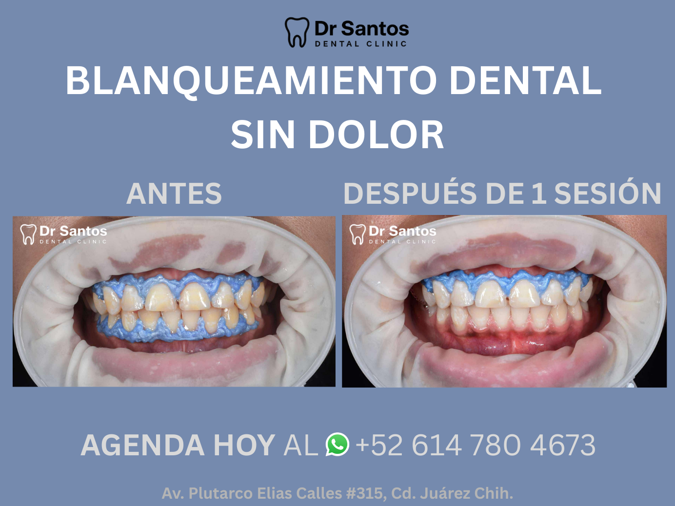 Resultado dental 3