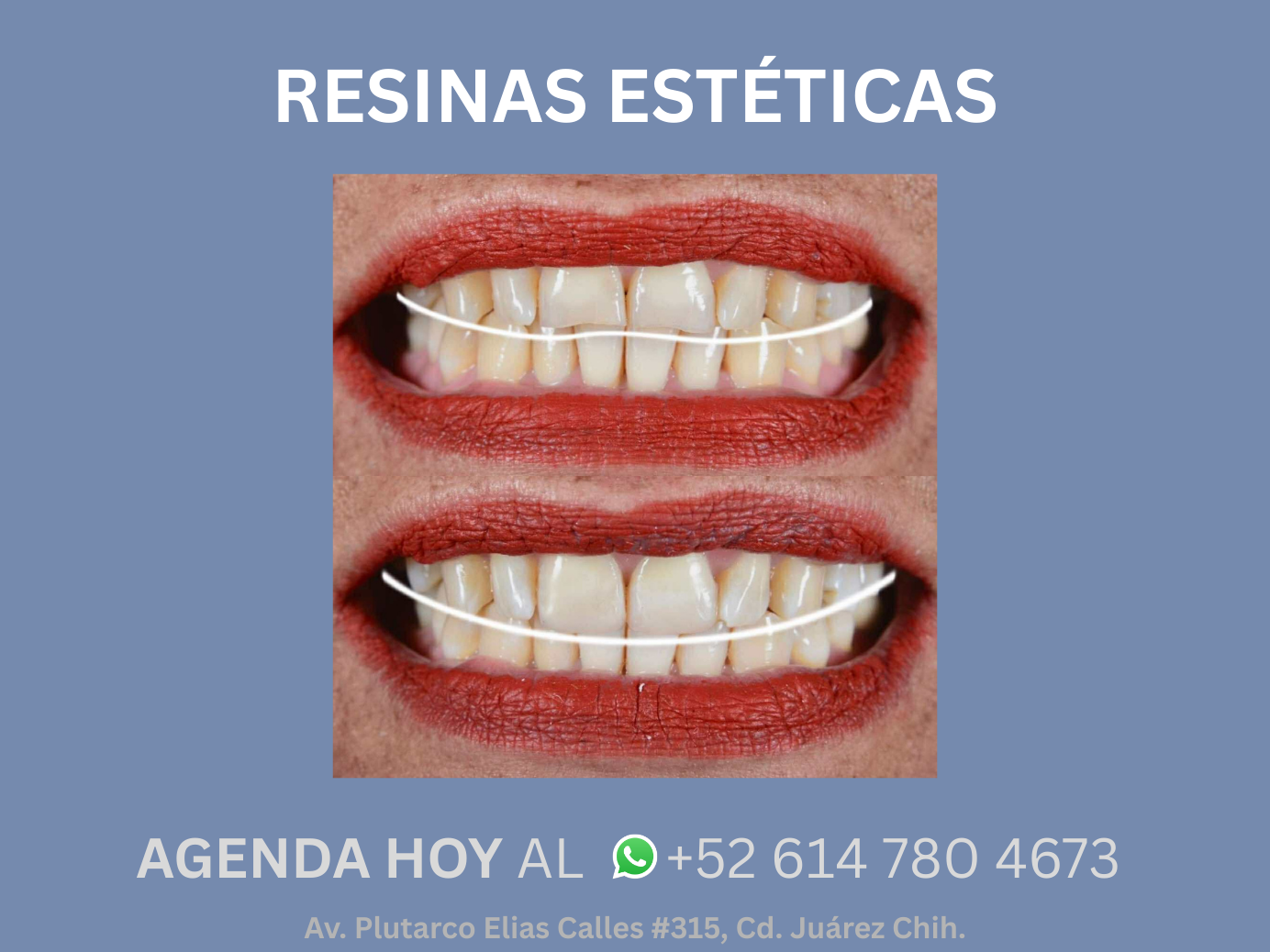 Resultado dental 5